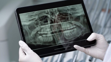 The New Standard in Dental Treatment Precision
