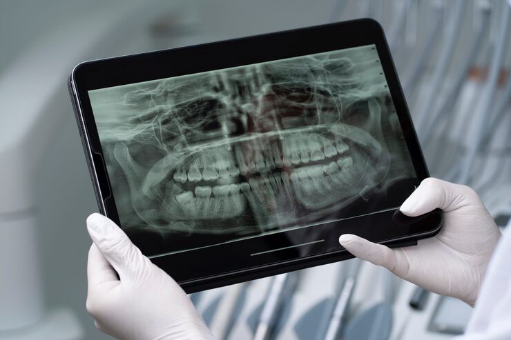 The New Standard in Dental Treatment Precision